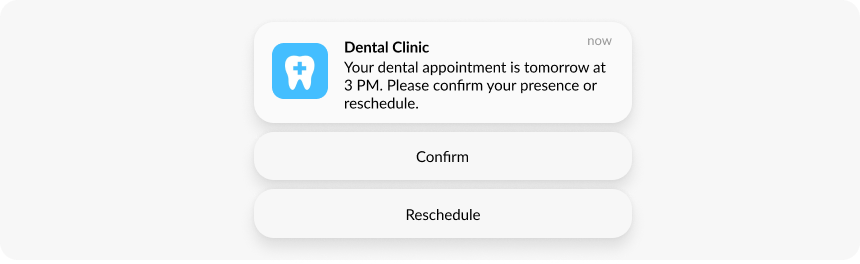 Rich push notification with interactive elements